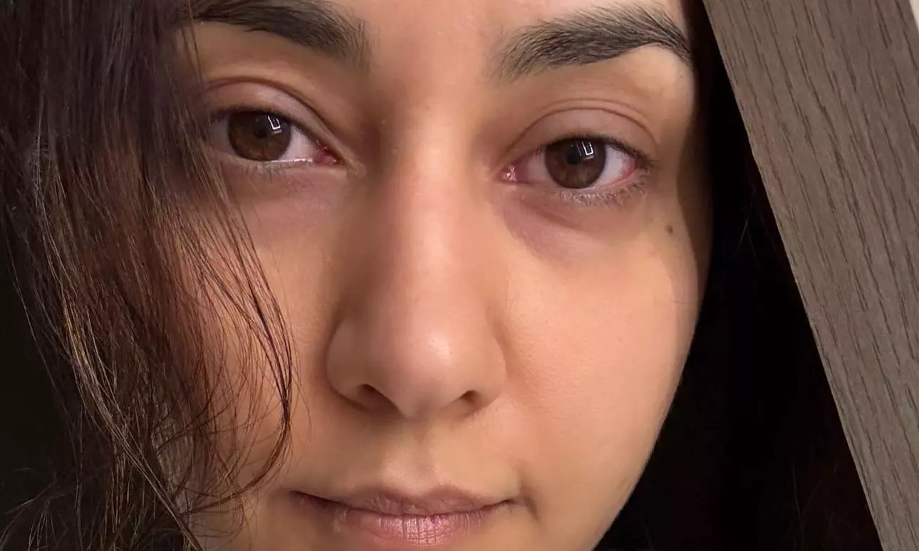 Raashi’s Sad Red Eyes Shock Everyone Today