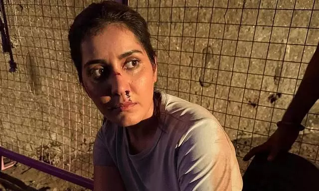 Raashi Khanna’s Bloody Nose Post Leaves Fans Puzzled