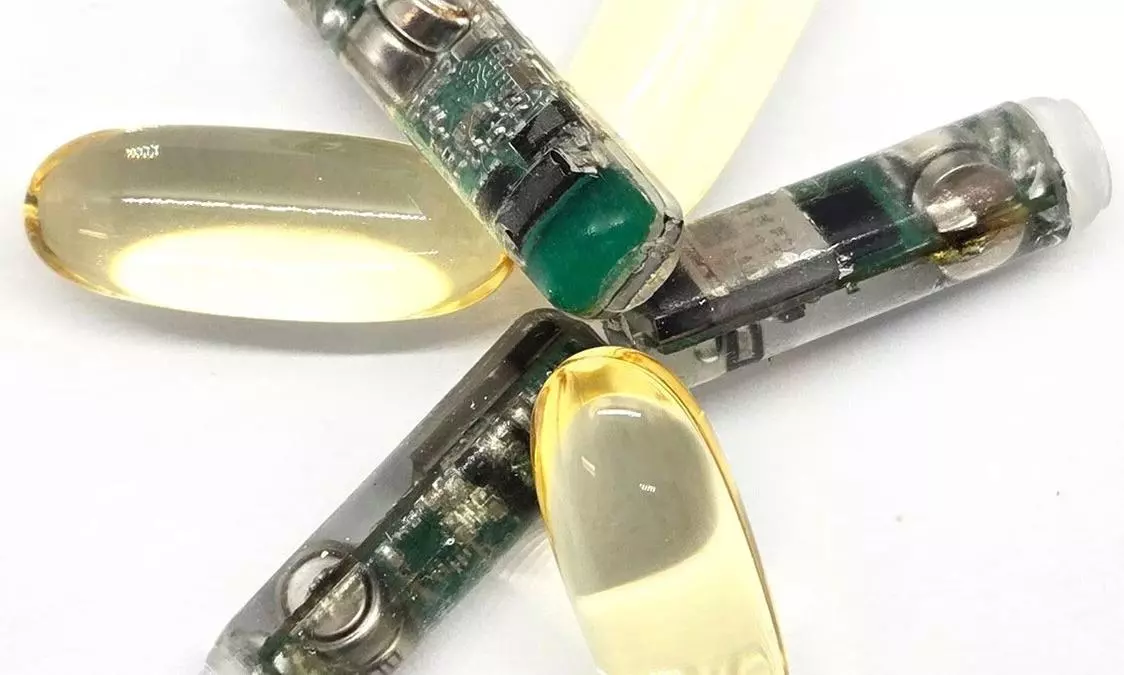 This Smart Pill Can Now Read Your Gut Like Never Before