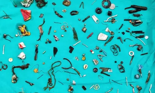 వ్యక్తి కడుపులో తాళాలూ, తాయత్తులు...ఏందయ్యా ఇదే?