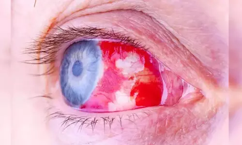 ఫ్రాన్స్ లో వణుకు పుట్టిస్తున్న ప్రమాదకర ఇన్ ఫెక్షన్