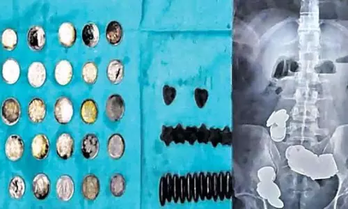 తెలివి చల్లగుండా... దేహానికి జింక్‌ అవసరమని ఇలా చేస్తాడా?