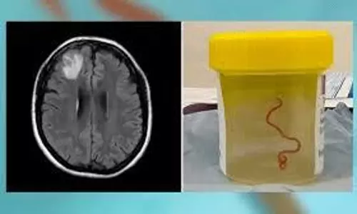 చేతులు సరిగా శుభ్రం చేసుకోకపోతే ఆ వ్యాధి వస్తుంది తెలుసా?