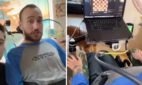 మస్క్‌ మామూలోడా.. మెదడులో చిప్‌ పెట్టి చెస్‌ ఆడించాడు!