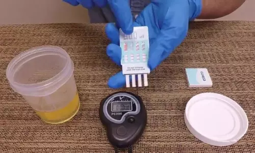 ఏమిటీ ఎబోన్ యూరిన్ కప్ ఎగ్జామ్? టీ పోలీసులు ఎందుకు చేస్తారు?