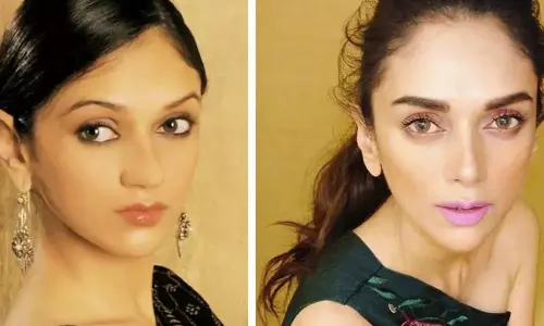 పిక్ టాక్‌ : ఆపరేషన్ తర్వాత గుర్తు పట్టలేనంత మార్పు