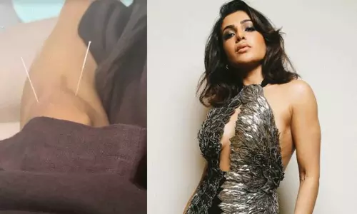 సమంతకు గాయం.. ఏం జరిగింది..