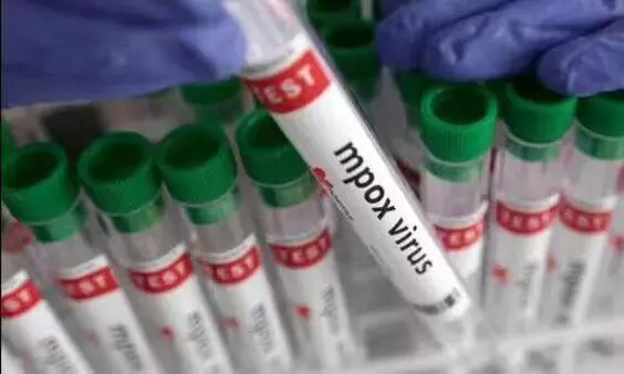 Monkeypox Threat Worrying Indian Government!