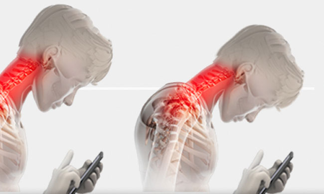 View of Got Tech Neck? Read More To Find Out | CNY Brain and Spine