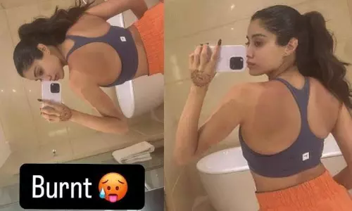 ఎర్ర‌గా బొబ్బ‌లెక్కిన వీపు చూపించిన యువ‌న‌టి