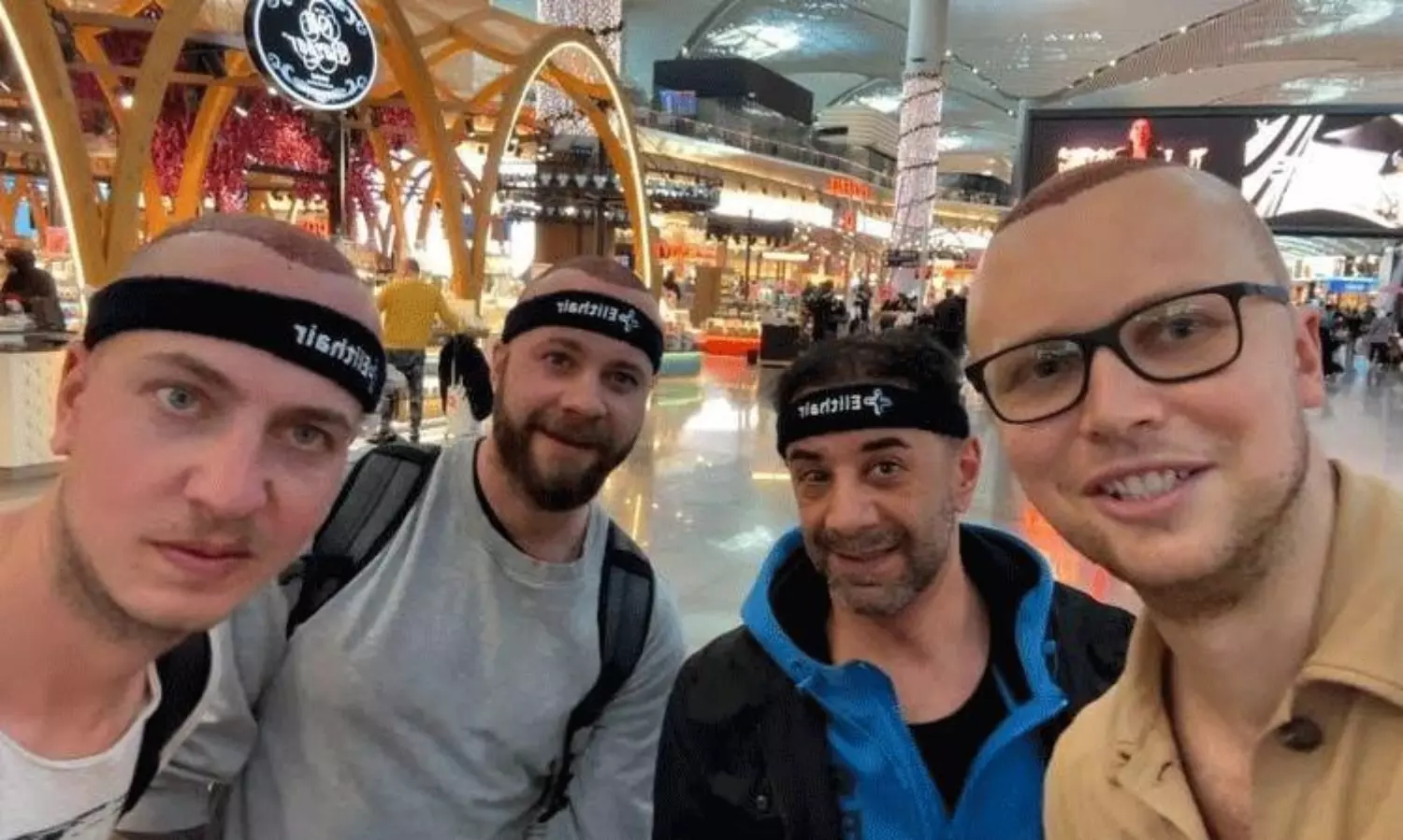 తుర్కియేలో ఎక్కడ చూసినా బట్టతల బాధితులే.. తుర్కియేలో ఎక్కడ చూసినా బట్టతల బాధితులే..