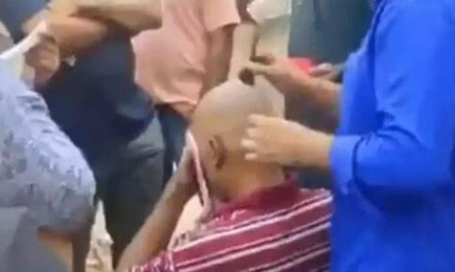 Delhi Man Cons Hundreds With Hair Regrowth Scam in Hyderabad Delhi Man Cons Hundreds With Hair Regrowth Scam in Hyderabad