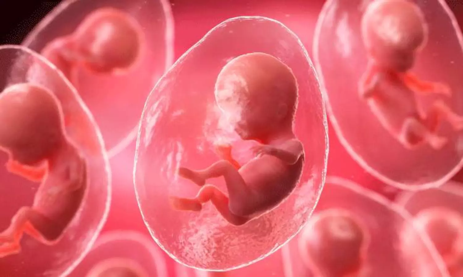 మానవ ప్రమేయం లేకుండానే శిశువు జననం.. మెక్సికో వైద్యుల అద్భుతం!