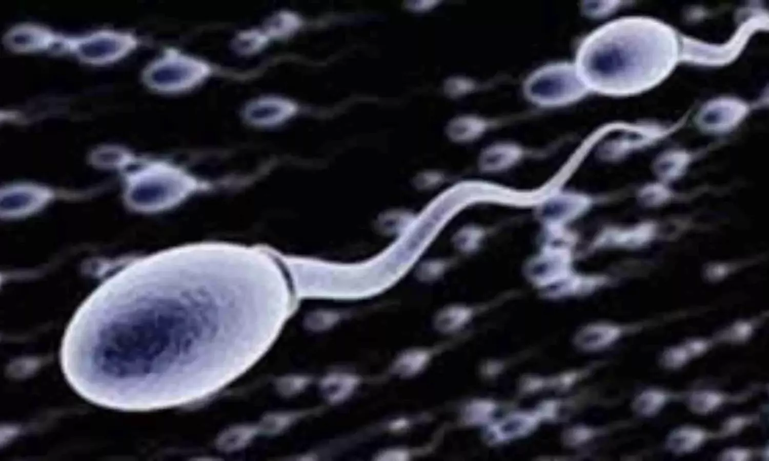 Sperm Race to Be Held in Los Angeles