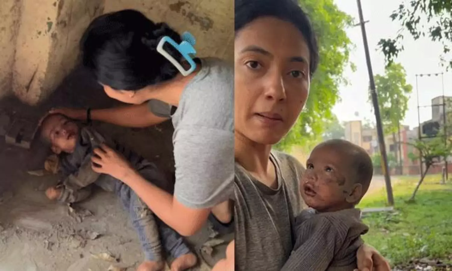 Khushboo Patani’s Bold Move to Save a Baby Khushboo Patani’s Bold Move to Save a Baby