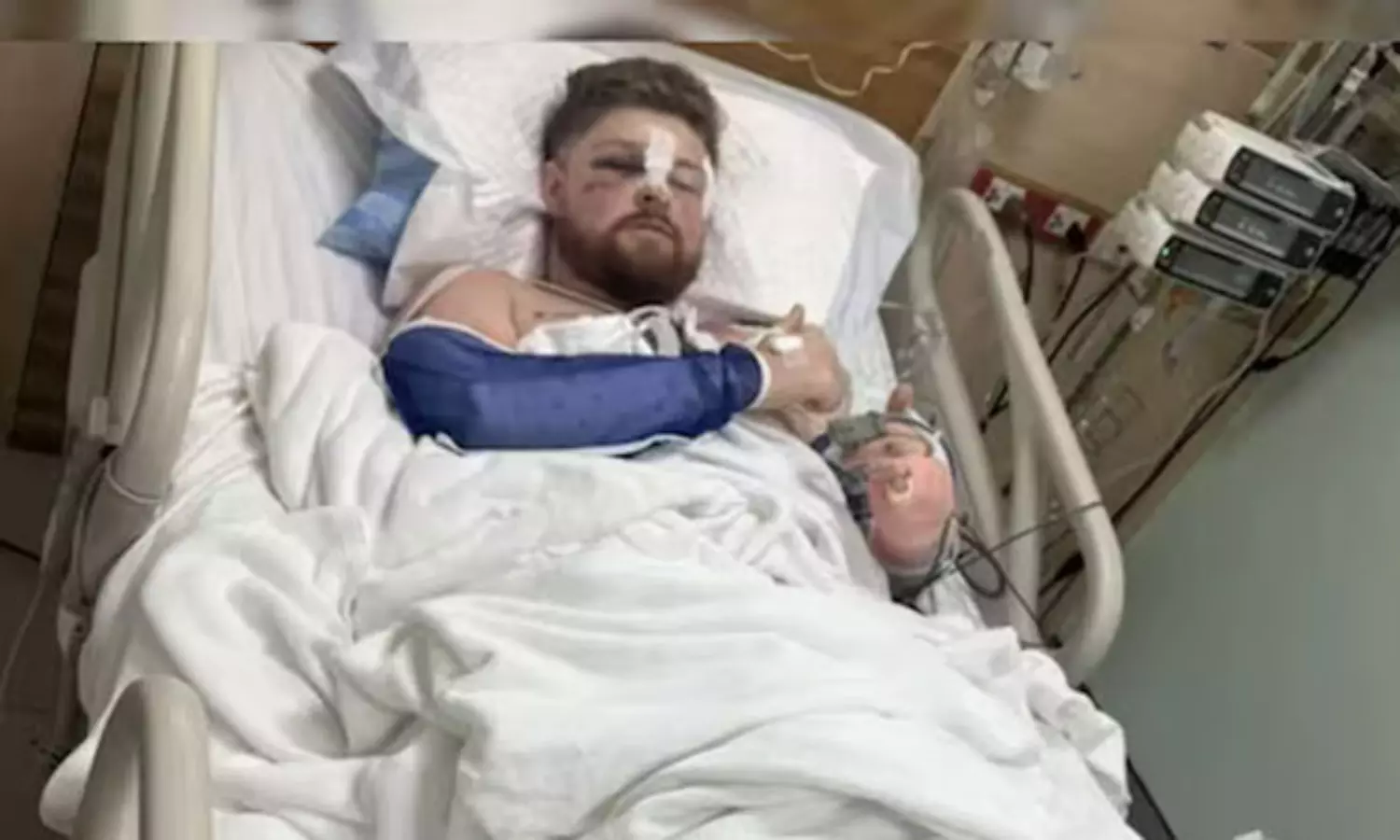 టిక్‌టాక్ మోజు ప్రాణాల మీదకు తెచ్చింది.. యూకే వ్యక్తికి రూ.1.13 కోట్ల ఆస్పత్రి బిల్లు