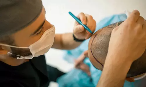 సెప్టిసెమిక్ షాక్ అంటే ఏమిటి? హెయిర్ ట్రాన్స్‌ప్లాంట్‌ సమయంలో దీని ప్రమాదమెంత ?