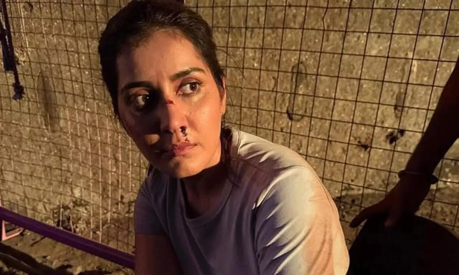 Raashi Khanna Bloody Nose In Shooting