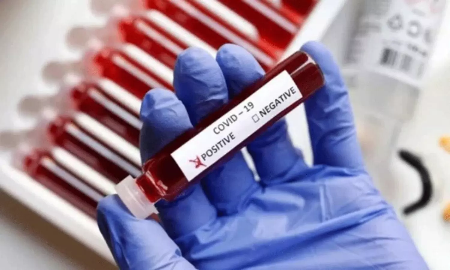 COVID Cases Rise Again in India JN.1 Variant Raises COVID Cases Rise Again in India JN.1 Variant Raises