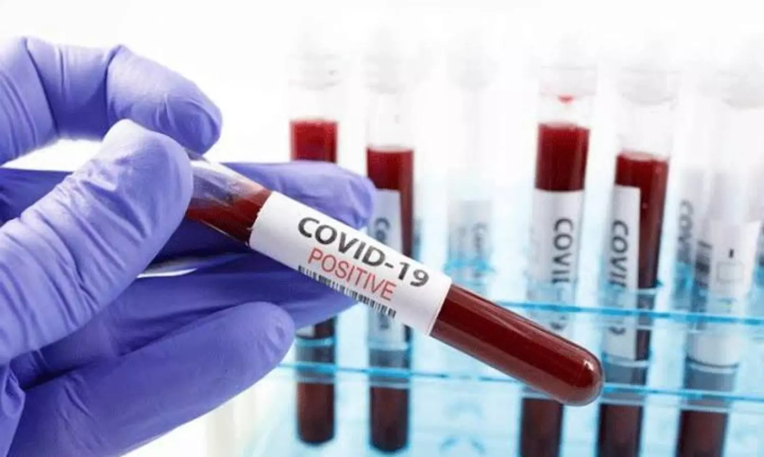 విశాఖలో కరోనా... బీచ్ సిటీ అలెర్ట్!