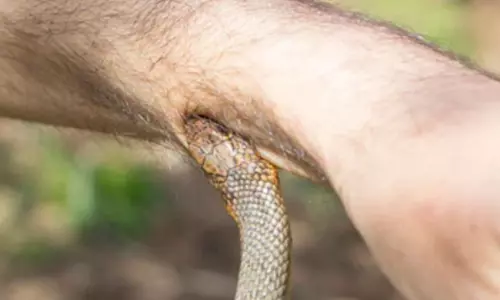 47 మందిని 280 సార్లు  చంపారు... ఏమిటీ పాము కాటు స్కామ్?