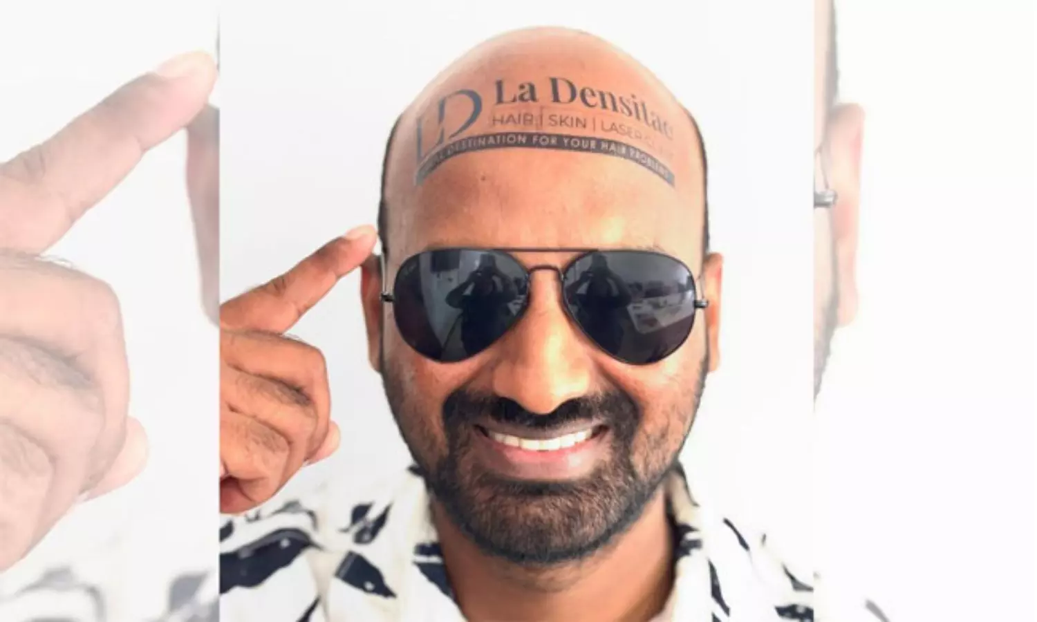 బట్టతలతో బ్రాండ్బిల్డింగ్ బట్టతలతో బ్రాండ్బిల్డింగ్