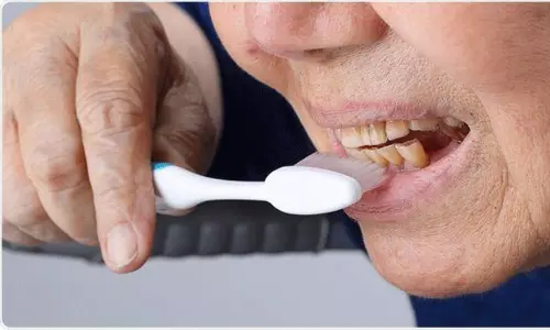 పళ్లు తోమడం లేదా.. క్యాన్సర్ తో పోతారు