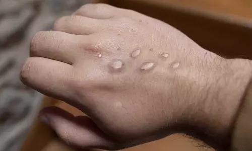 ప్రపంచానికి మరో ముప్పు