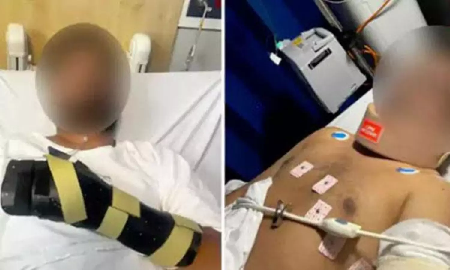 చేయి తెగేదాకా.. ఆస్ట్రేలియాలో మరో భారతీయ విద్యార్థిపై కత్తి దారుణం