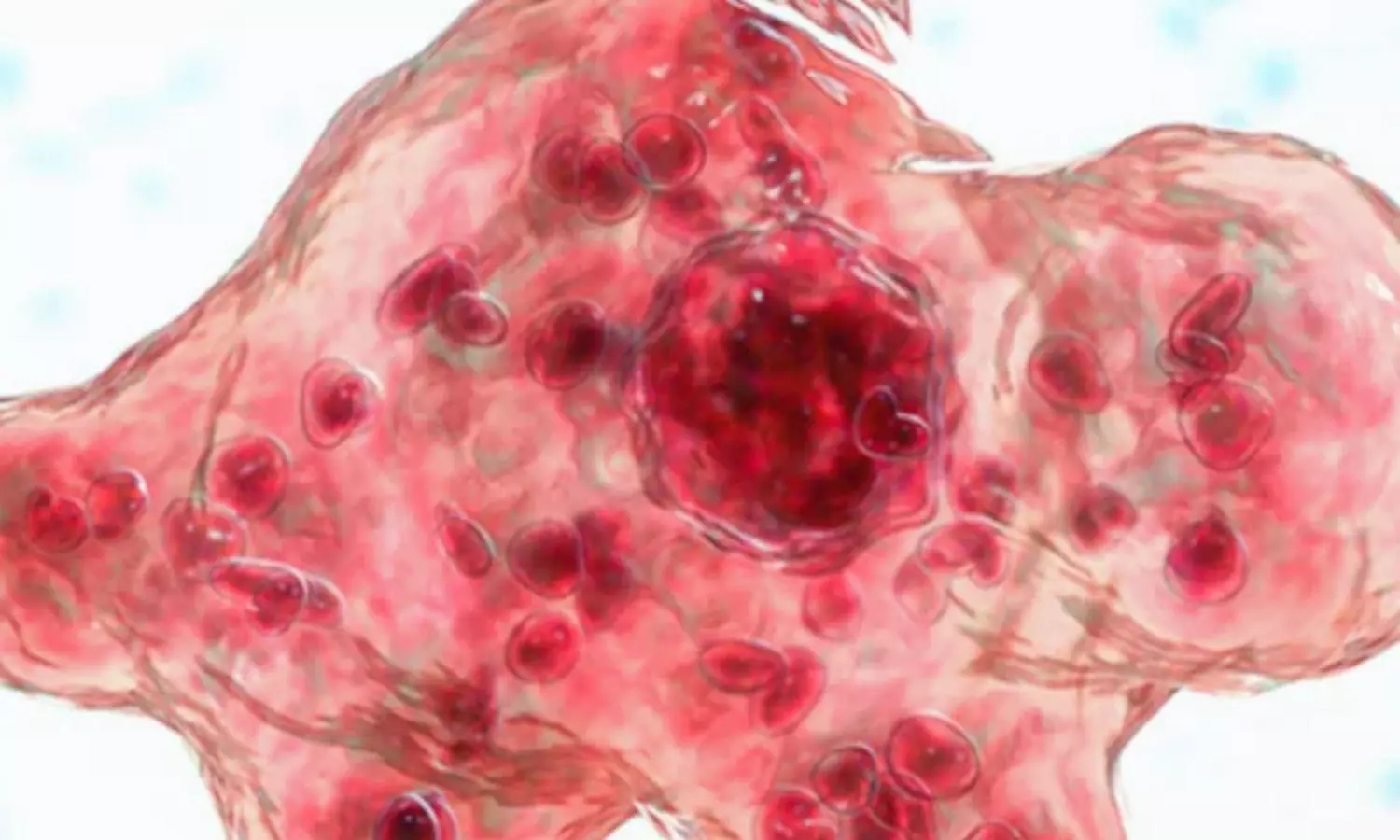 అమీబాతో చిన్నారి మృతి.. కేరళలో కళకలం