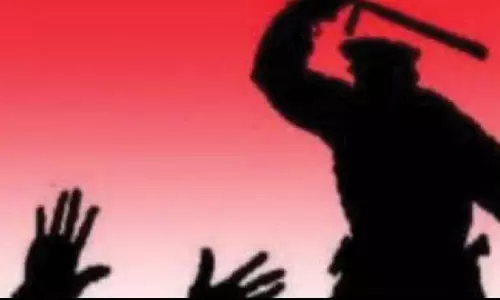 గంజాయి బ్యాచ్ కు ఒంగోలు పోలీసుల ట్రీట్ మెంట్ తప్పు లేదు బాస్