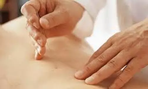 గోల్డ్-థ్రెడ్ ఆక్యుపంక్చర్ చికిత్సతో లాభమా? నష్టమా? :  వైద్యులు ఏం చెబుతున్నారు