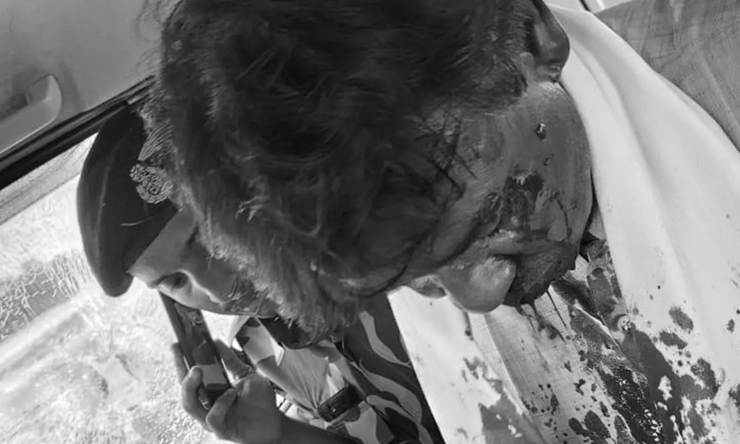 రక్తం వచ్చేలాగా ఎంపీని రౌండ్ చేసి కొట్టారు