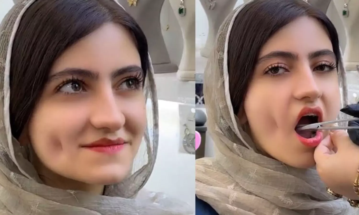 అందం కోసం రిస్క్.. ఈ అమ్మాయి ఏం చేసిందో తెలిస్తే షాక్!