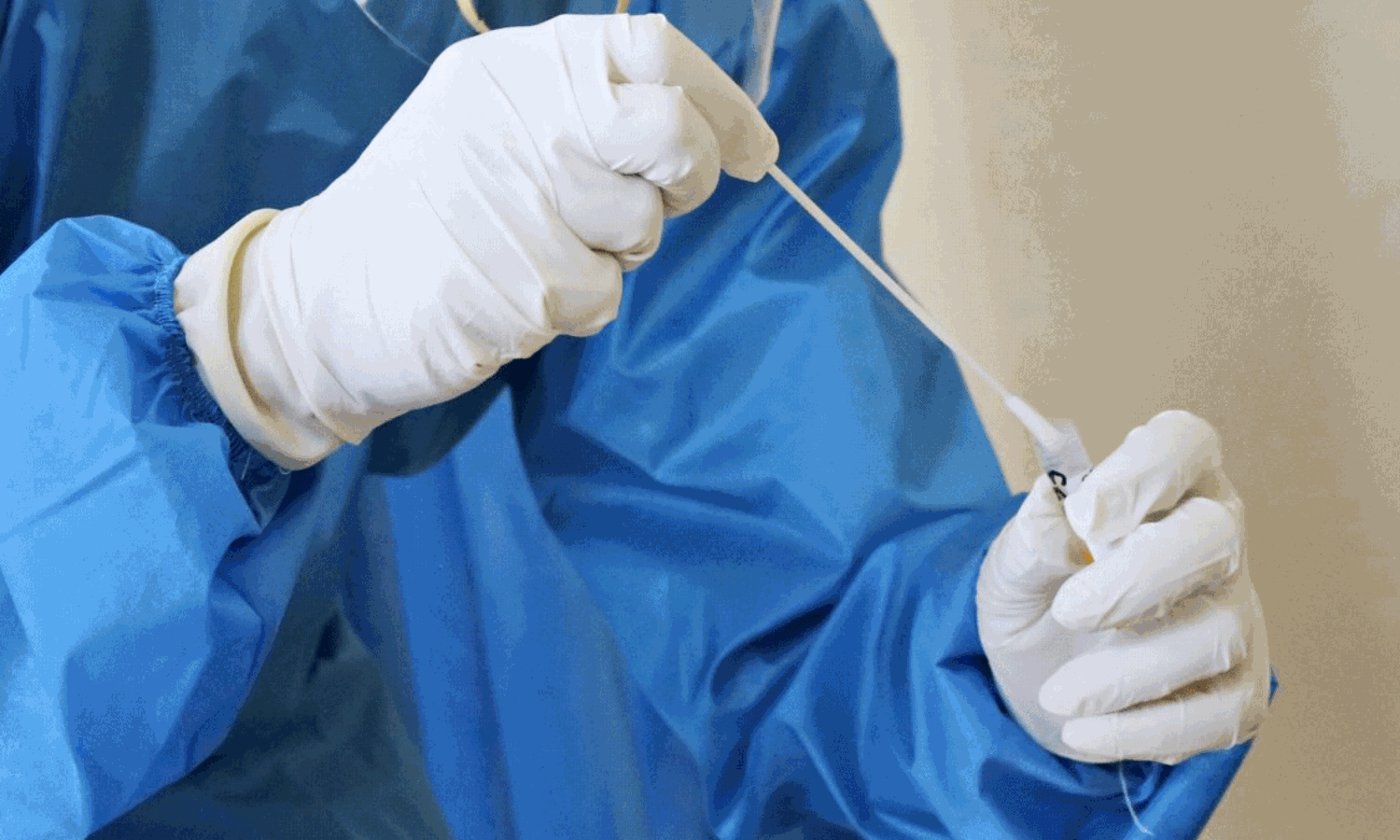 డీఎన్ ఏ పరీక్షల కోసం ఎగబడుతోన్న ఉగాండ పురుషులు