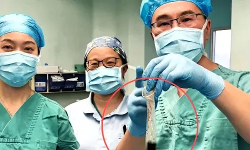 కడుపులో కండోమ్... డాక్టర్ చేసిన పనికి అంతా షాక్