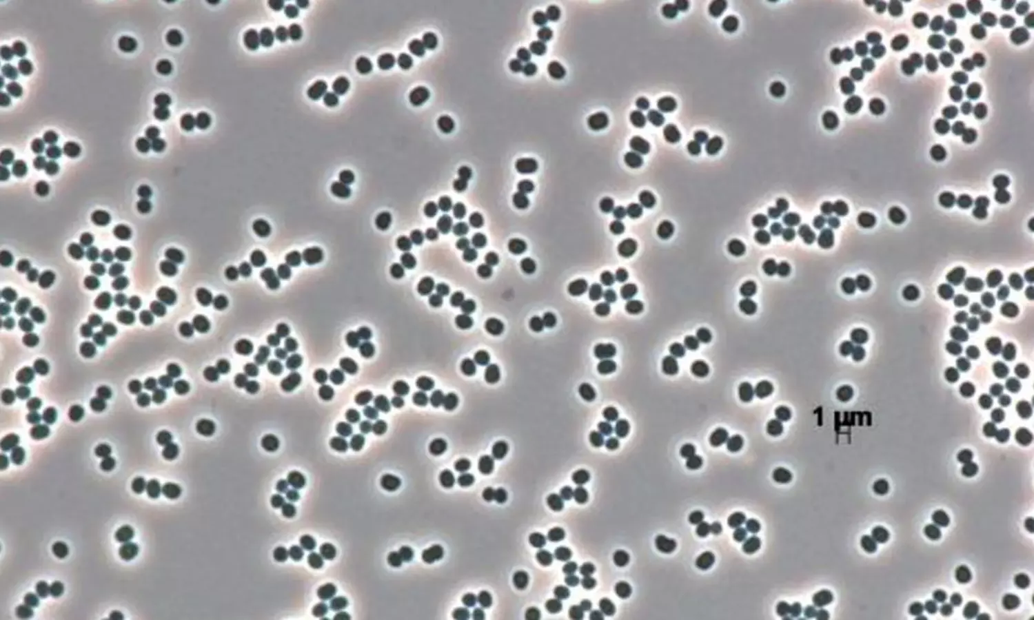 ఇదో మహానటి.. చనిపోయినట్టు నటించే బ్యాక్టీరియా..దగ్గరికెళ్ళామో..?