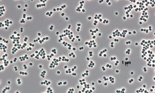 ఇదో మహానటి.. చనిపోయినట్టు నటించే బ్యాక్టీరియా..దగ్గరికెళ్ళామో..?