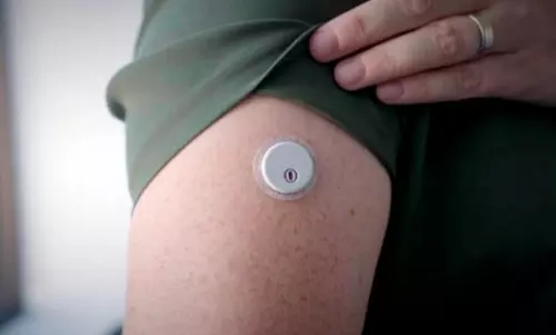 ప్రాణాంతకంగా మారిన గ్లూకోస్ మానిటర్స్.. FDA హెచ్చరిక..