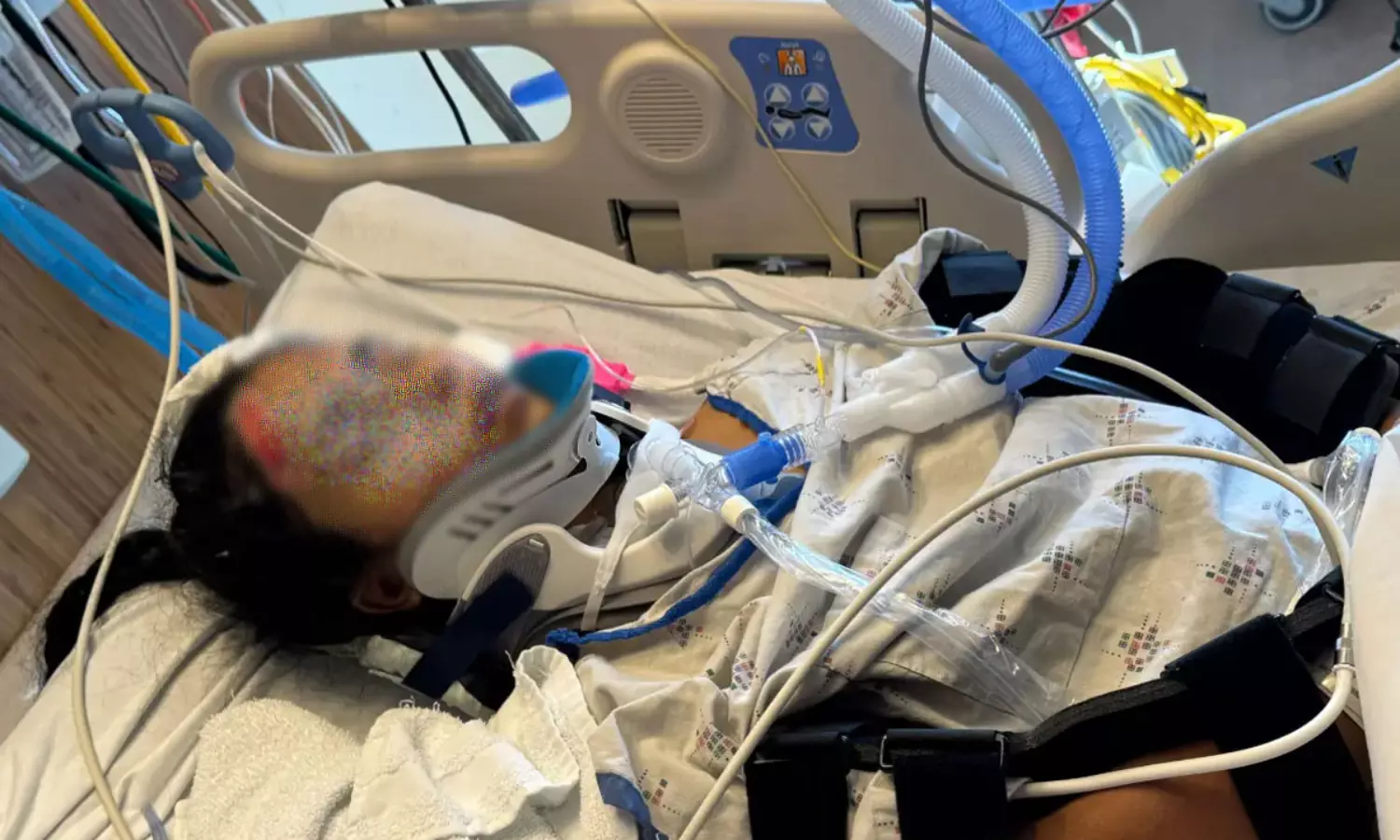 అమెరికాలో కోమాలో భారతీయ యువతి.. అండగా మన కమ్యూనిటీ అమెరికాలో కోమాలో భారతీయ యువతి.. అండగా మన కమ్యూనిటీ