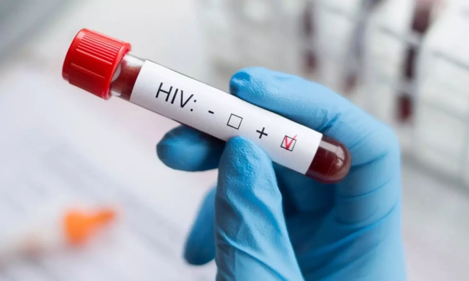 ఒక్క జిల్లా..8 వేల హెచ్ఐవీ కేసులు.. పిల్లలే 400 మంది ఒక్క జిల్లా..8 వేల హెచ్ఐవీ కేసులు.. పిల్లలే 400 మంది