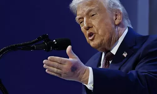 ట్రంప్ హెల్త్ కండీషన్ బాలేదా? అందుకే ఇలా ప్రవర్తిస్తున్నాడా?