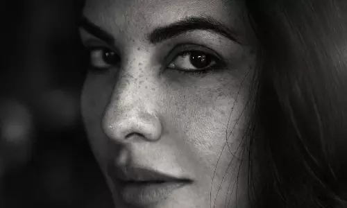 ముఖంపై మ‌చ్చ‌లు.. దాప‌రికం లేని టాప్ హీరోయిన్