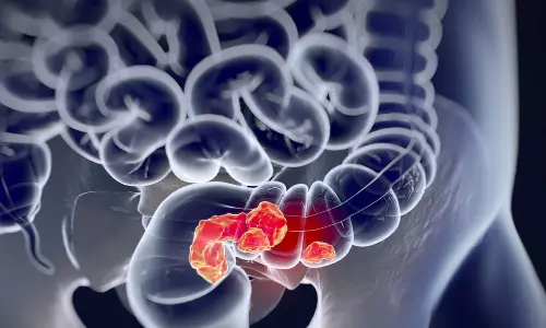 కీమో, సర్జరీ లేకుండానే క్యాన్సర్ చెక్… 4 నెలల్లో అద్భుత ఫలితం