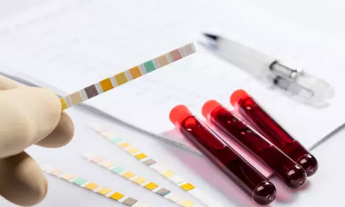 Coming Soon: Drug Tests In Telangana Assembly!