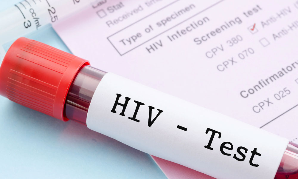 HIV Tests For Students? 7000 Cases? What’s The Reality? HIV Tests For Students? 7000 Cases? What’s The Reality?
