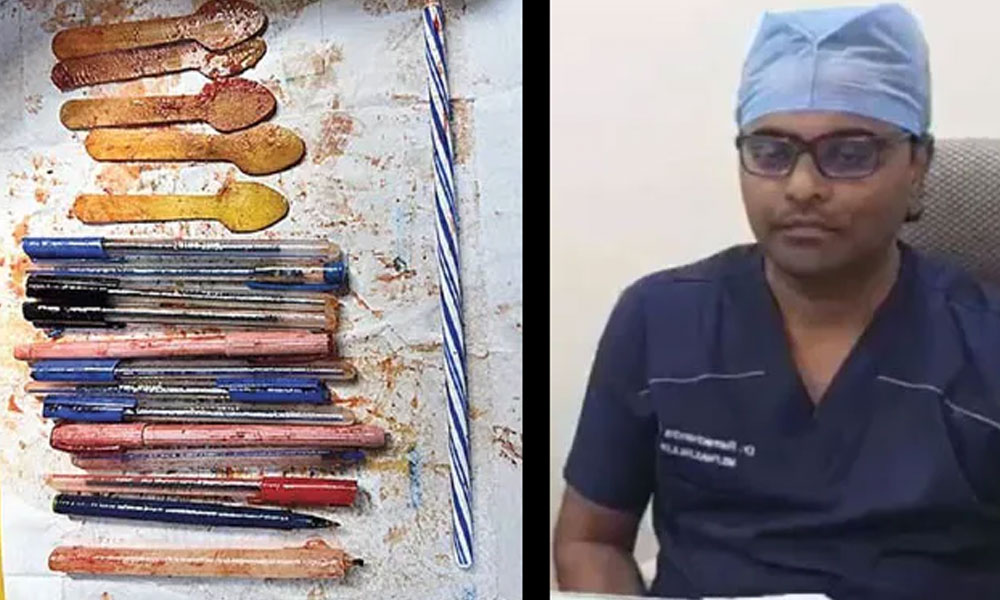 మహిళ కడుపులో 14 పెన్నులు, 5 స్పూన్స్‌