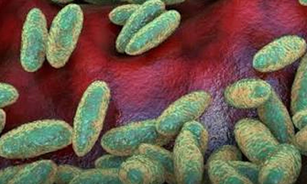 Breaking: America Asks Not To Travel To Russia Due To Plaque Outbreak! Breaking: America Asks Not To Travel To Russia Due To Plaque Outbreak!