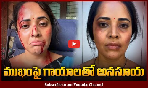 మొకం పై గాయాలతో అనసూయ  | Anasuya Latest Viral Pics | Tupaki