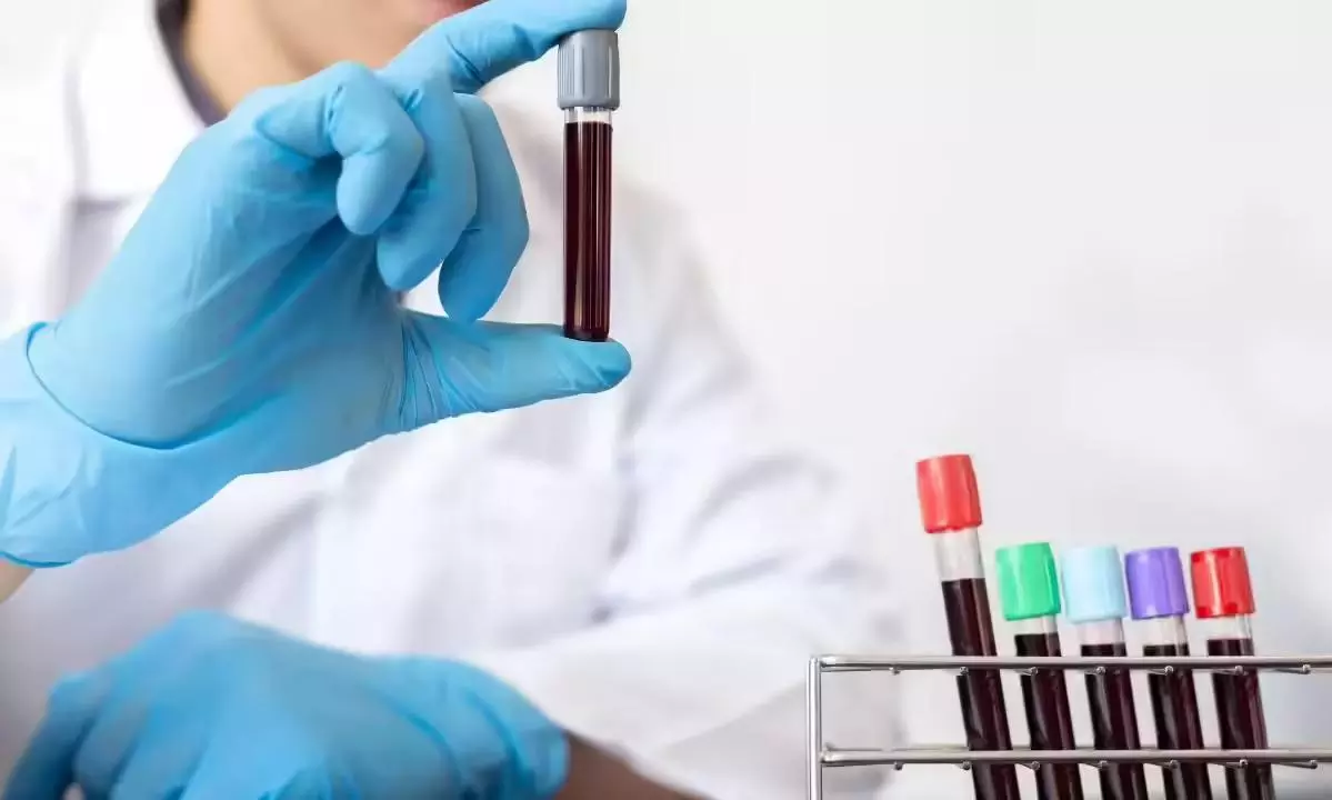 బ్లడ్  గ్రూపుకు ‘బెంగళూరు’ పేరు... అరుదైన రక్తం ఈమెకు  మాత్రమే సొంతం!